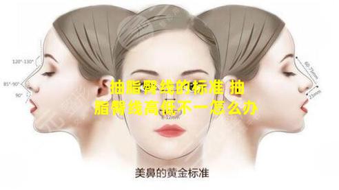 抽脂臀线的标准 抽脂臀线高低不一怎么办